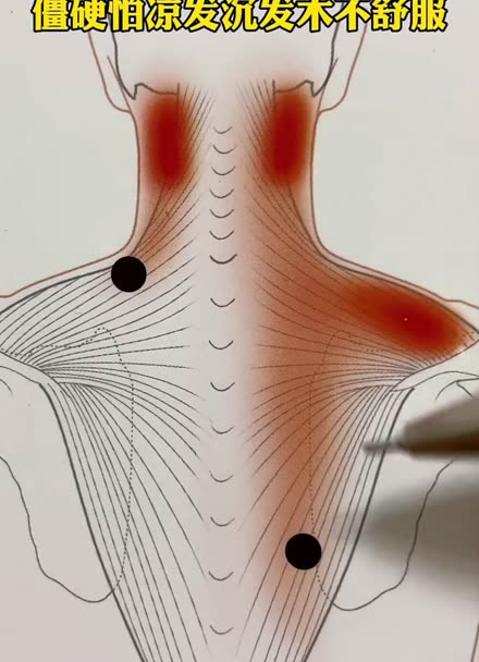 肩颈斜方肌准确位置图图片
