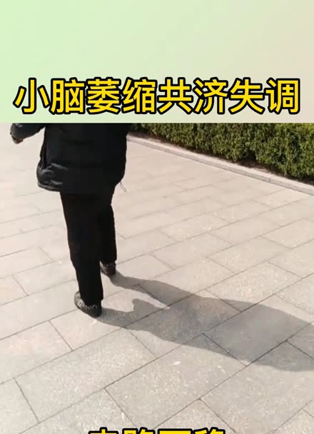 小脑萎缩共济失调症状表现