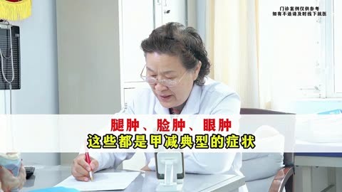 全身水腫發胖,腿腫,臉腫,眼腫,這些都是甲減典型的症狀!