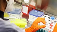 中疾控：10月新增报告127例猴痘确诊病例